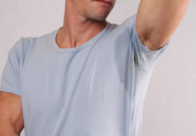 Advanced management of excessive sweating