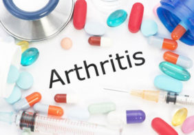 Arthritis – Classification and treatment