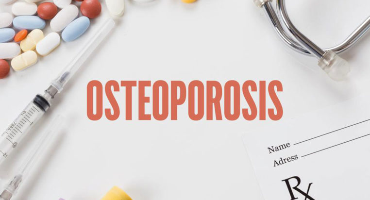 Bone density testing – An important diagnostic tool for osteoporosis