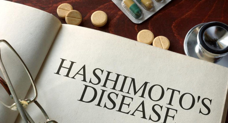 Causes and symptoms of hashimotos disease