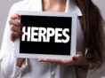 Effective alternative treatments to cure herpes