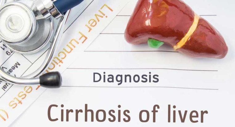 Liver Cirrhosis and its 4 Stages