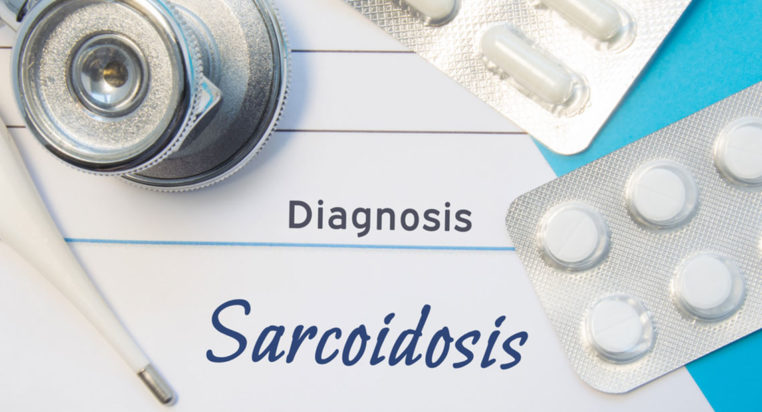Sarcoidosis risk factors you should know about