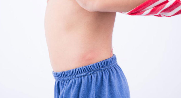 Ten types of skin rashes you should know about