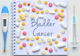 Things to know about the different stages of bladder cancer