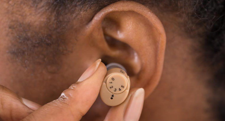The cost factors for Hearing Aids