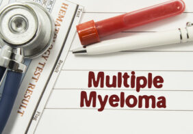 6 early signs of multiple myeloma